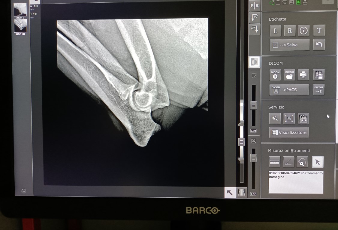 Ecografia e Radiografia